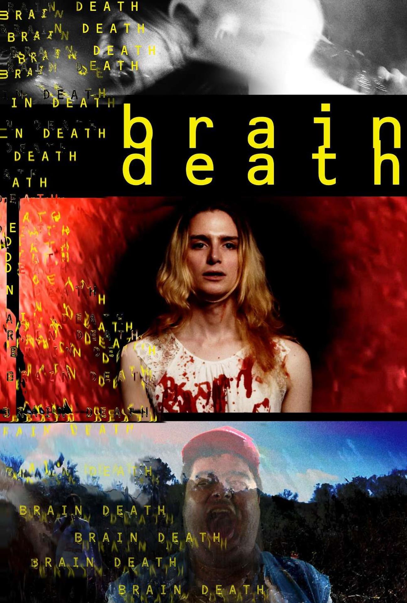 Brain Death